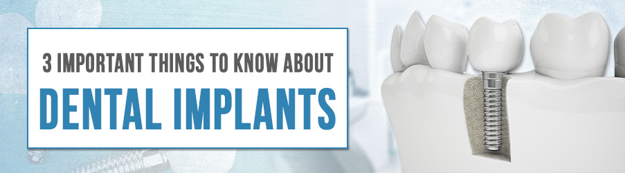 3 Important Things to Know About Dental Implants - One Stop Implants