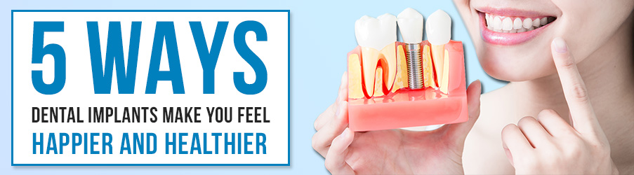 5 Ways Dental Implants Make You Feel Happier and Healthier