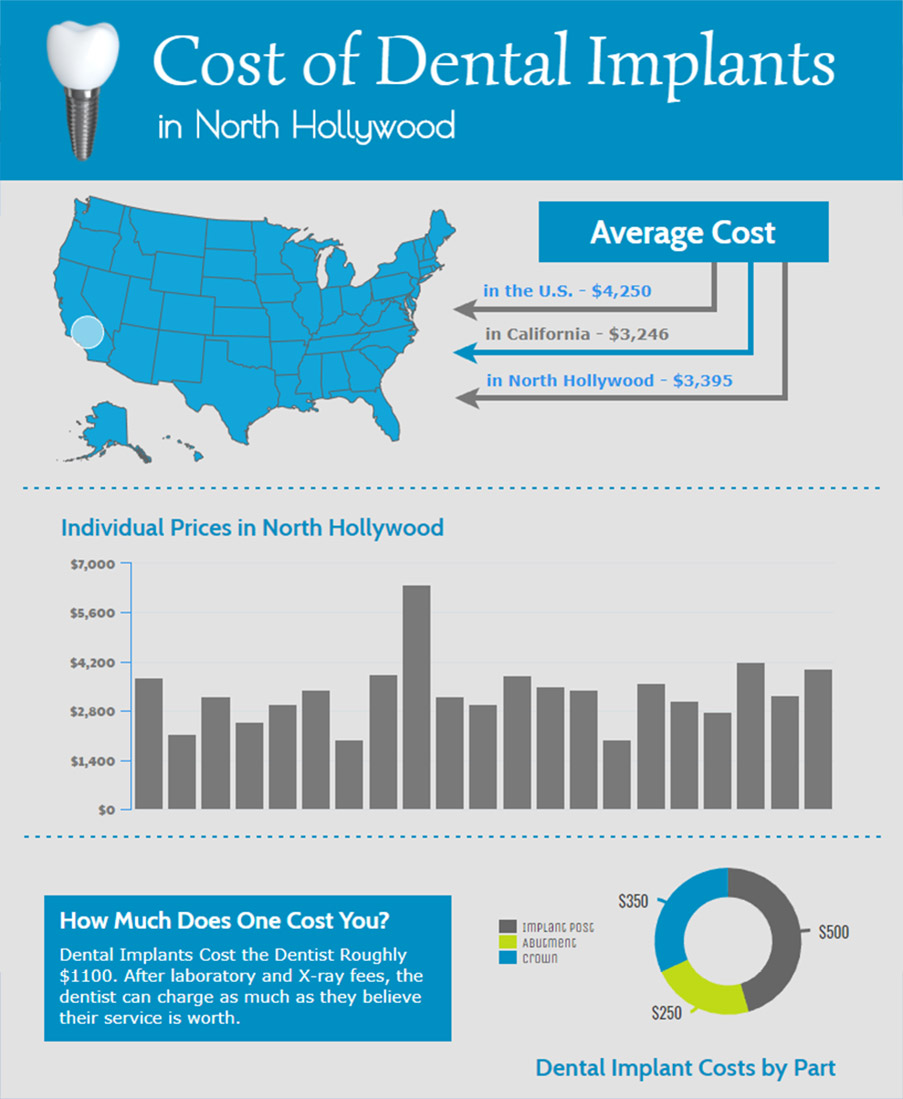 Dental Implant Costs in North Hollywood