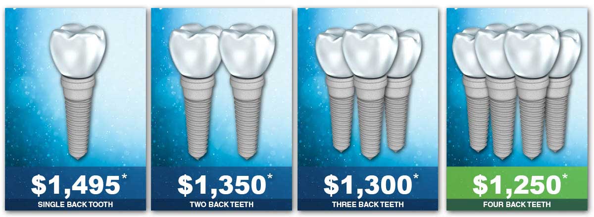 Is it costly to get a dental implant?