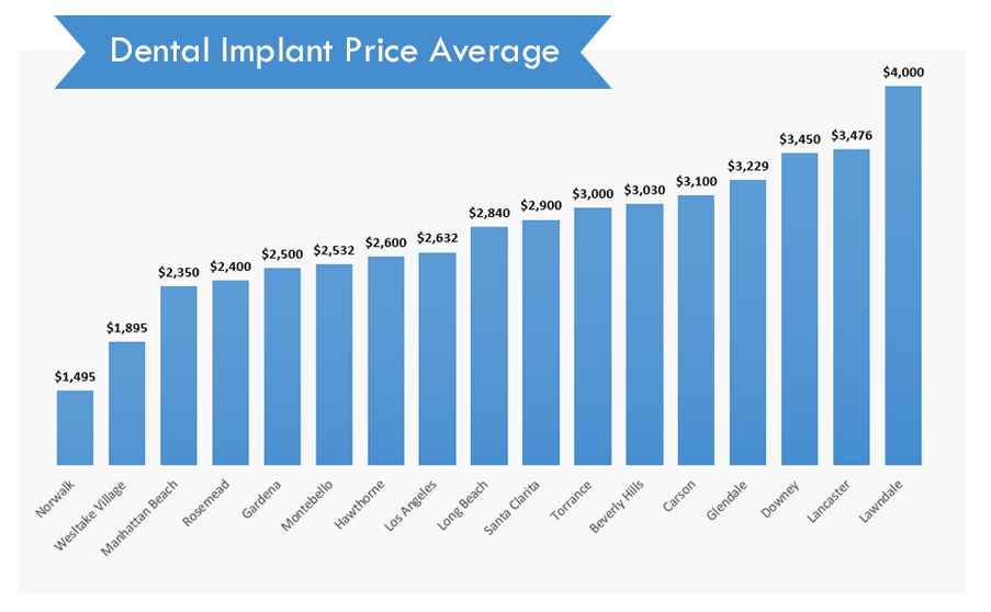 Dental Implant Prices Average in Los Angeles
