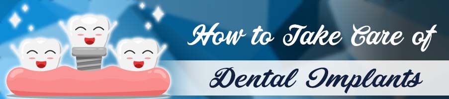 How to Take Care of Dental Implants