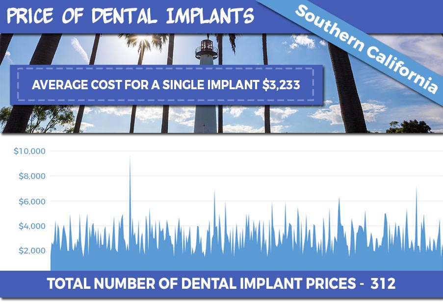 Dental Implants, Why They Are Right For You