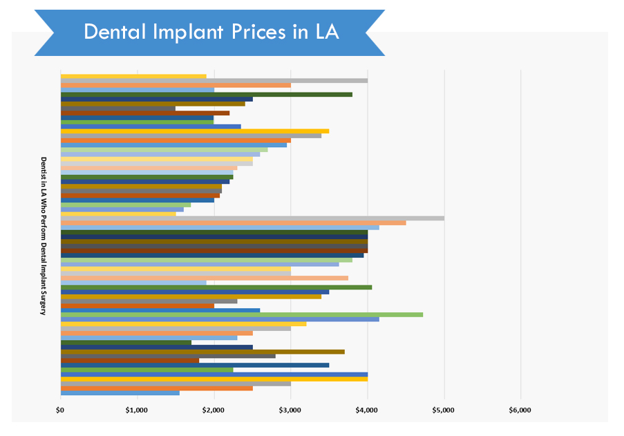 A Complete Price Guide For Dental Implants In Los Angeles