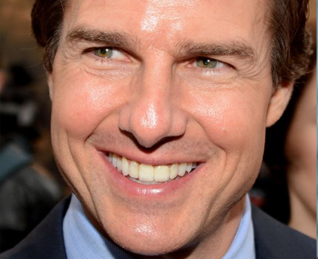 Tom Cruise After Cosmetic Dentistry