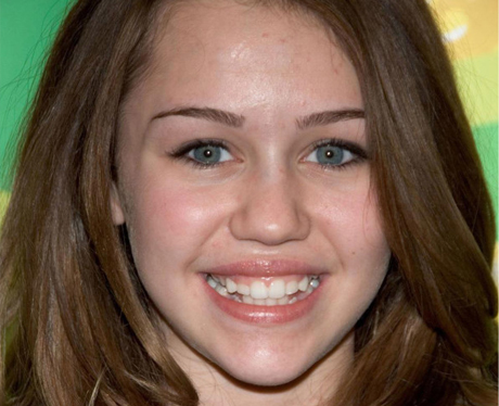 Miley Cyrus Before Cosmetic Dentistry