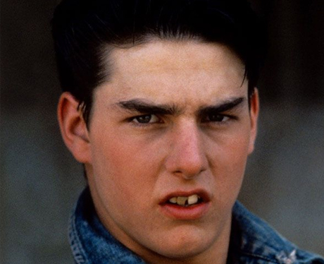 Tom Cruise Before Cosmetic Dentistry