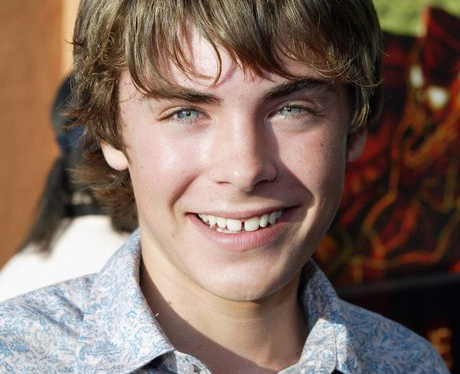 Zac Efron Before Cosmetic Dentistry