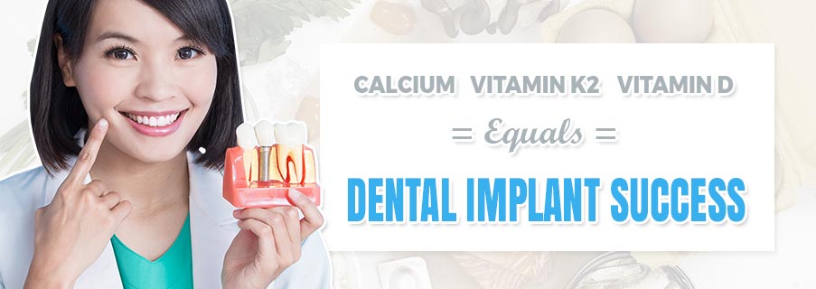 How Calcium, Vitamin D and Vitamin K2 Equal Dental Implant Success