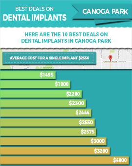 Best Deals / Lowest Prices on Dental Implants in Canoga Park