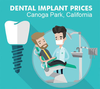 Dental Implant Costs in Canoga Park