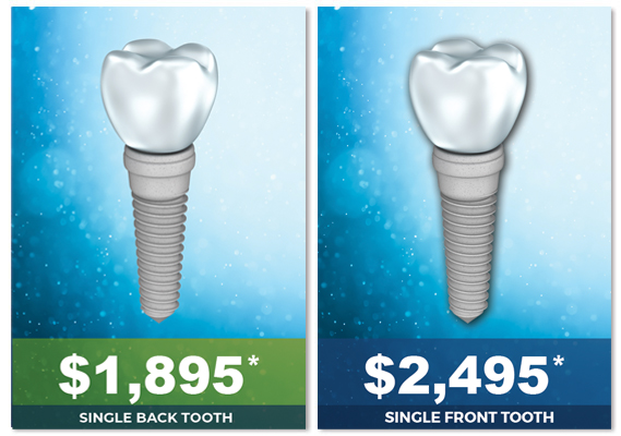 Memphis Dentures and Implants