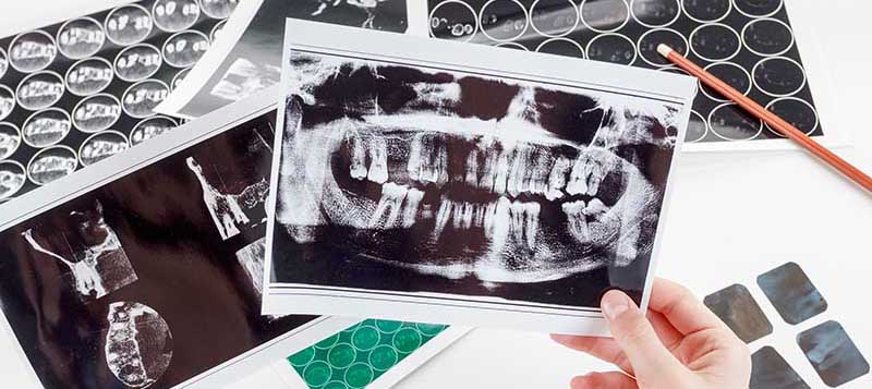 Dentist with Patient Showing Xray of Oral Cavity