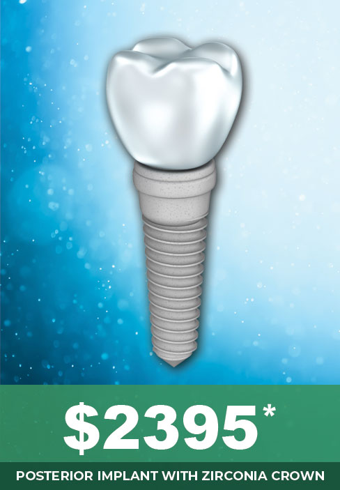 Back Tooth Dental Implant Cost