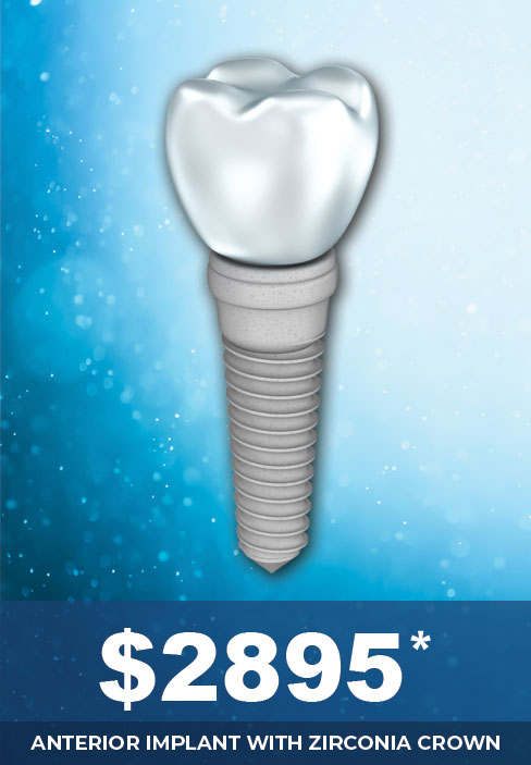 Front Tooth Dental Implant Cost